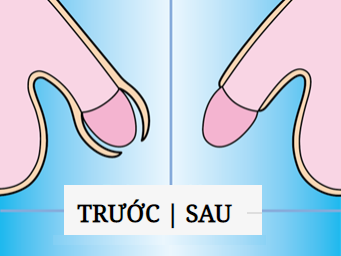 14-TUOI-CAT-BAO-QUY-DAU-DA-DUOC-CHUA